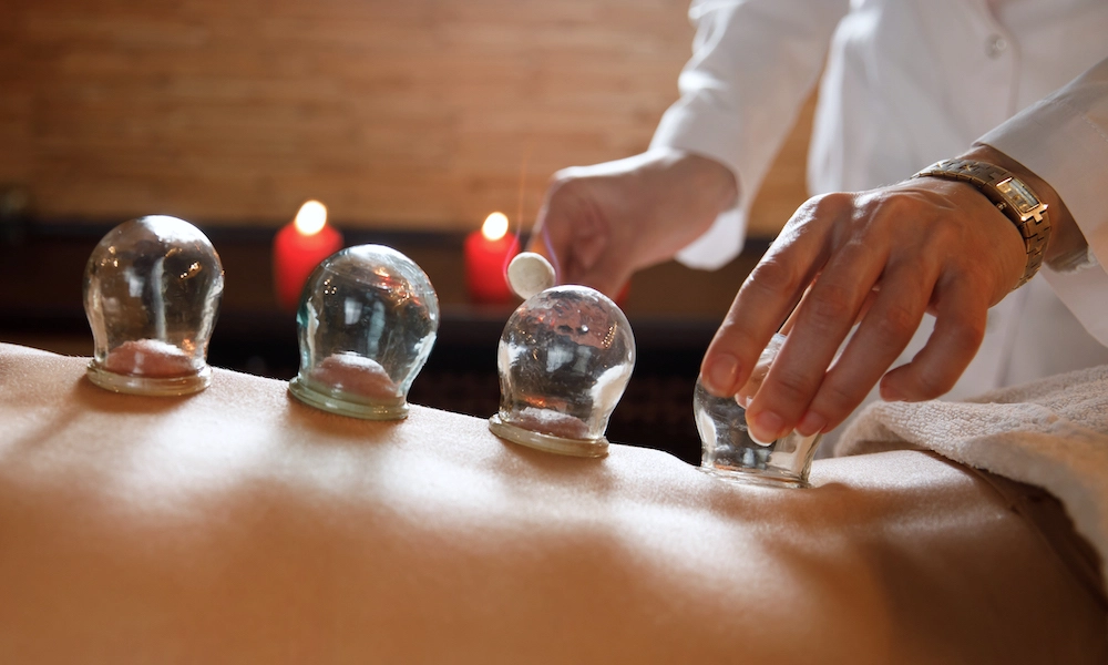 Professional Cupping Therapy Kildare - by Cupping Therapists