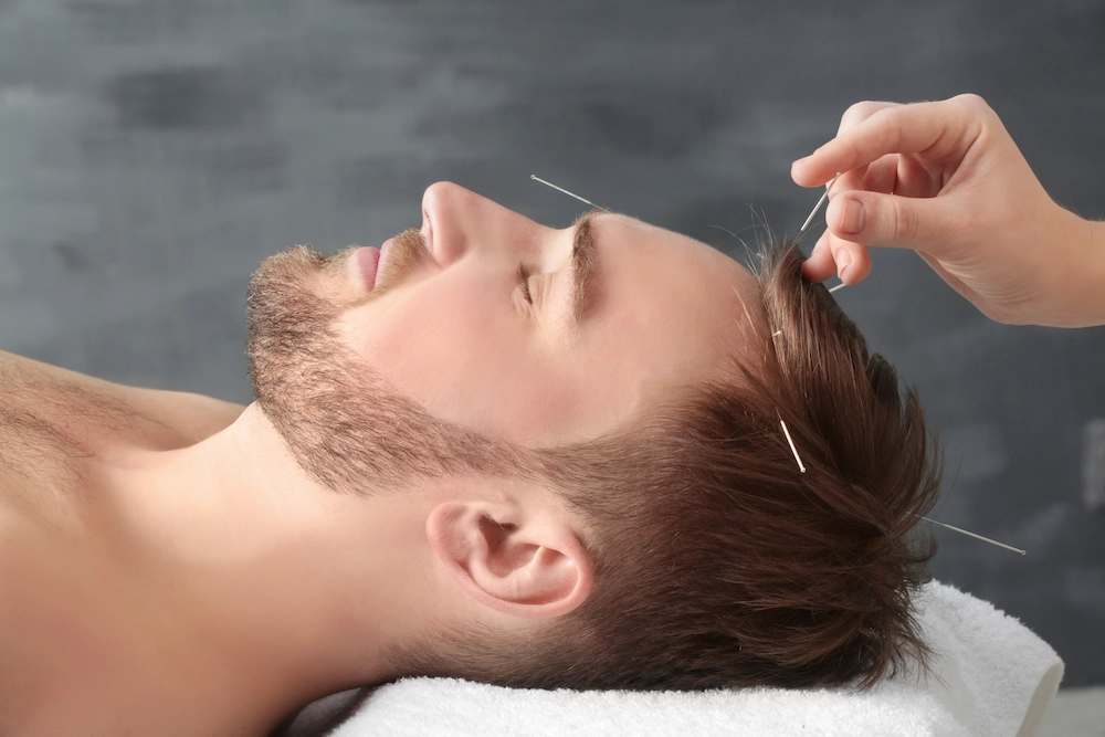 Dublin Acupuncture Therapy