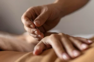 acupuncture treatment for anxiety